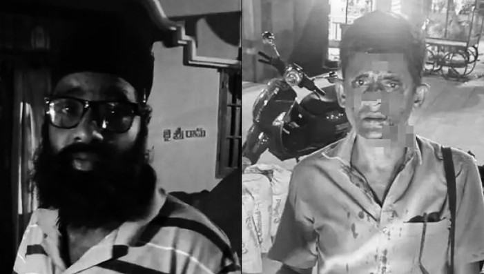 ఆల్వాల్‌లో ఆర్టీసీ కండకర్ట్ పై దాడి..